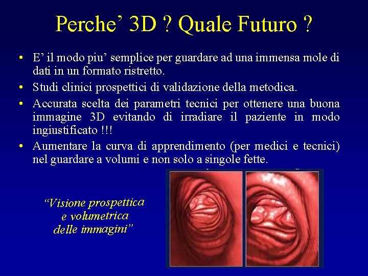 Perche’ 3 D ? Quale Futuro ? • E’ il modo piu’ semplice per