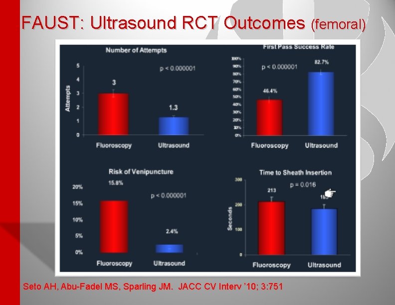 FAUST: Ultrasound RCT Outcomes (femoral) Seto AH, Abu-Fadel MS, Sparling JM. JACC CV Interv