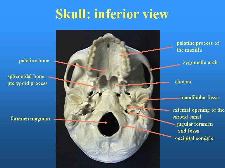 Skull: inferior view palatine process of the maxilla palatine bone sphenoidal bone: pterygoid process