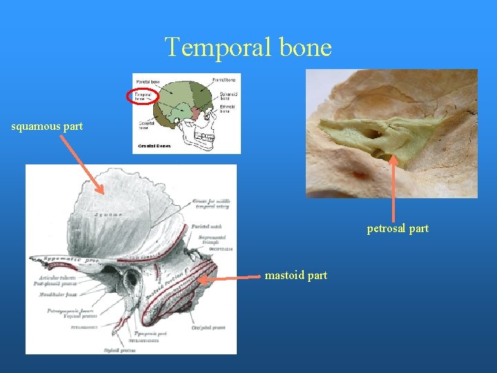 Temporal bone squamous part petrosal part mastoid part 