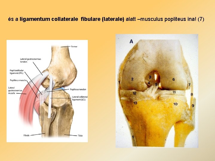 és a ligamentum collaterale fibulare (laterale) alatt –musculus popliteus ina! (7) 