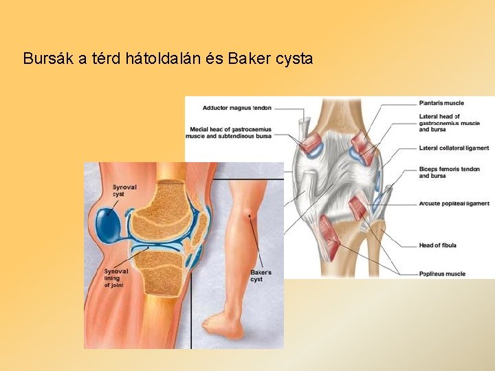 Bursák a térd hátoldalán és Baker cysta 