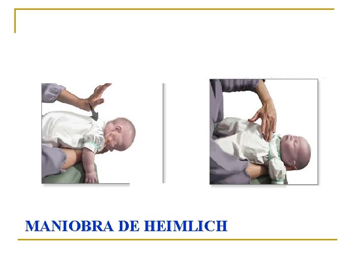 MANIOBRA DE HEIMLICH 