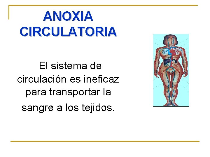 ANOXIA CIRCULATORIA El sistema de circulación es ineficaz para transportar la sangre a los