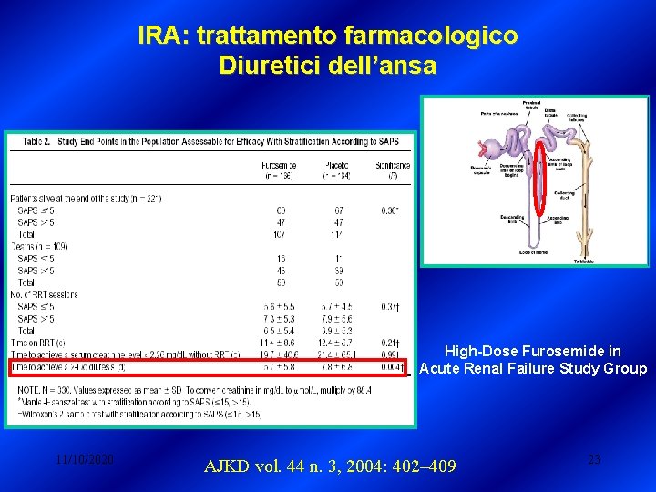 IRA: trattamento farmacologico Diuretici dell’ansa High-Dose Furosemide in Acute Renal Failure Study Group 11/10/2020 IRA: trattamento farmacologico Diuretici dell’ansa High-Dose Furosemide in Acute Renal Failure Study Group 11/10/2020