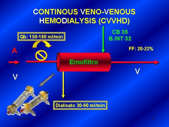 CONTINOUS VENO-VENOUS HEMODIALYSIS (CVVHD) CB 35 B. INT 32 Qb: 150 -180 ml/min FF: CONTINOUS VENO-VENOUS HEMODIALYSIS (CVVHD) CB 35 B. INT 32 Qb: 150 -180 ml/min FF: