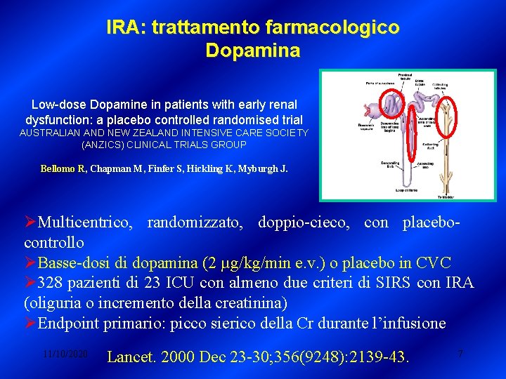 IRA: trattamento farmacologico Dopamina Low-dose Dopamine in patients with early renal dysfunction: a placebo IRA: trattamento farmacologico Dopamina Low-dose Dopamine in patients with early renal dysfunction: a placebo
