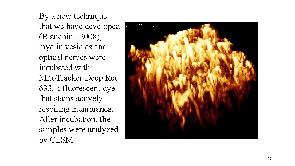 By a new technique that we have developed (Bianchini, 2008), myelin vesicles and optical