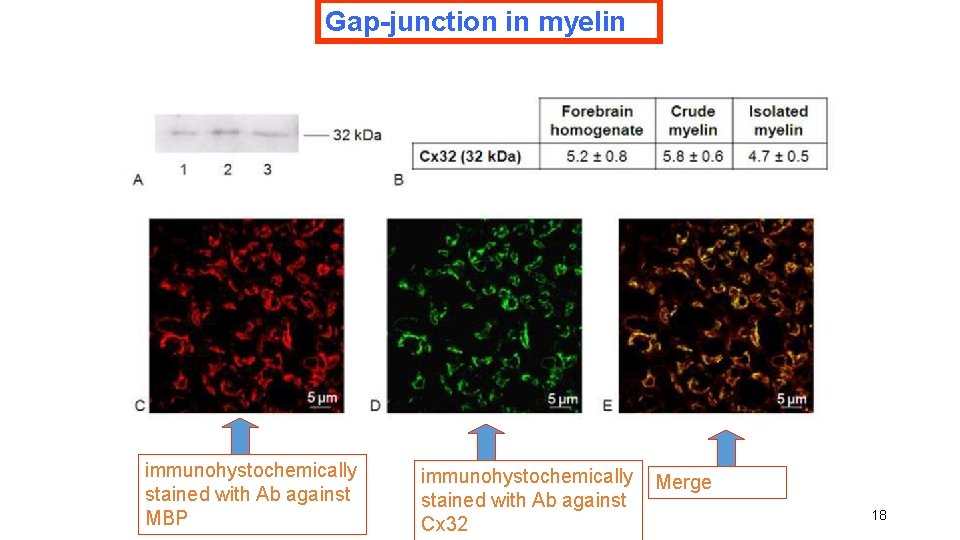 Gap-junction in myelin immunohystochemically stained with Ab against MBP immunohystochemically stained with Ab against