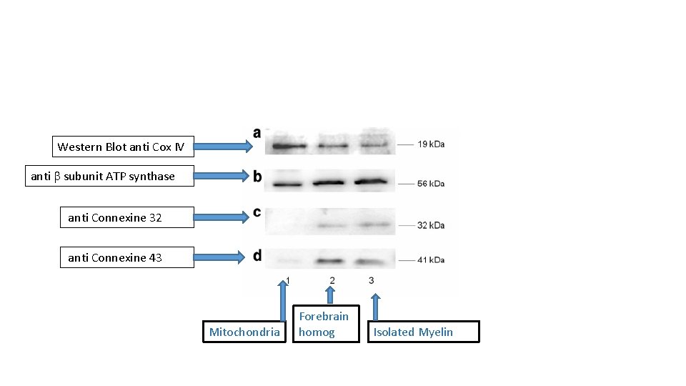 Western Blot anti Cox IV anti b subunit ATP synthase anti Connexine 32 anti