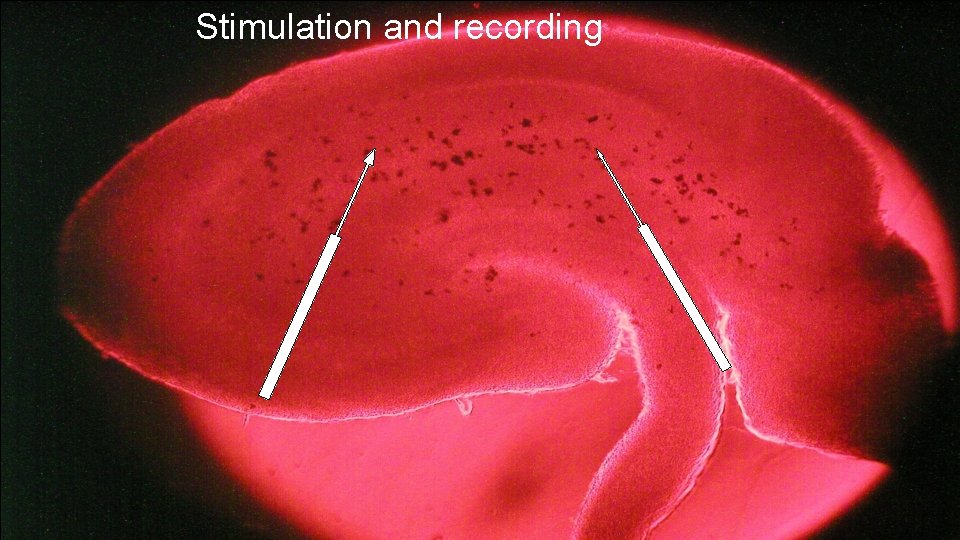 Stimulation and recording Adriano, Perasso, Ravera, Gandolfo, Mancardi, Panfoli, Morelli, Balestrino - 2009 