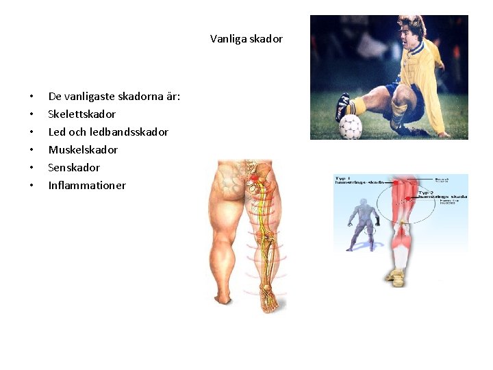 Vanliga skador • • • De vanligaste skadorna är: Skelettskador Led och ledbandsskador Muskelskador