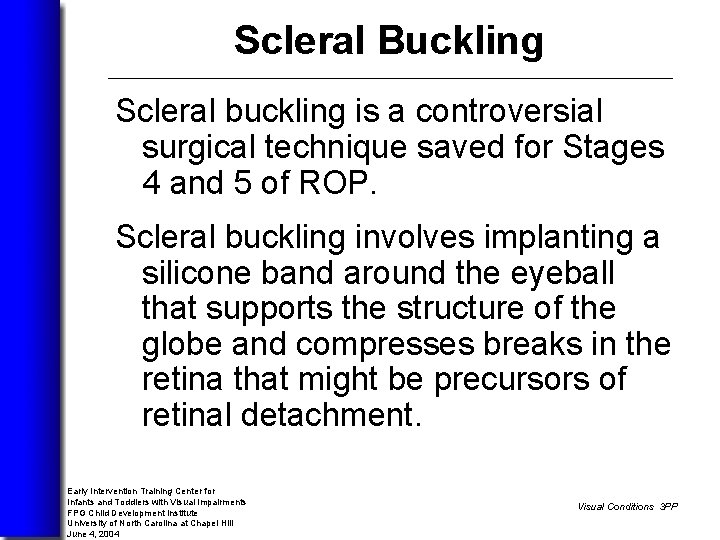Scleral Buckling Scleral buckling is a controversial surgical technique saved for Stages 4 and