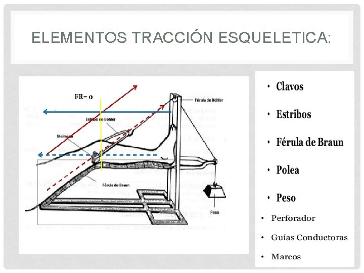 ELEMENTOS TRACCIÓN ESQUELETICA: 