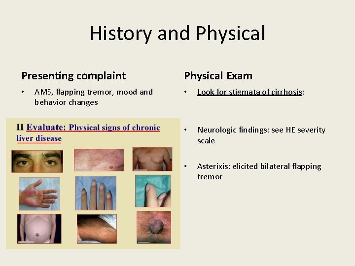 History and Physical Presenting complaint • AMS, flapping tremor, mood and behavior changes Physical