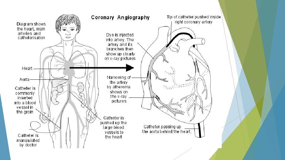 Case study Congestive Heart Failure Chief Complaint 68