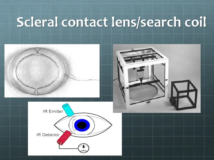 Scleral contact lens/search coil Scleral contact lens/search coil