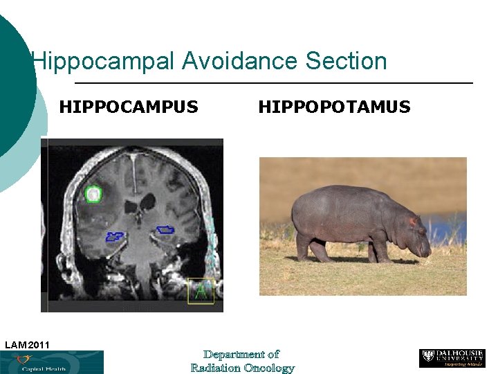 Hippocampal Avoidance Section HIPPOCAMPUS HIPPOPOTAMUS LAM 2011 34 