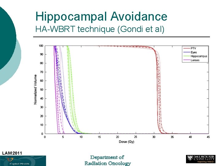 Hippocampal Avoidance HA-WBRT technique (Gondi et al) LAM 2011 40 