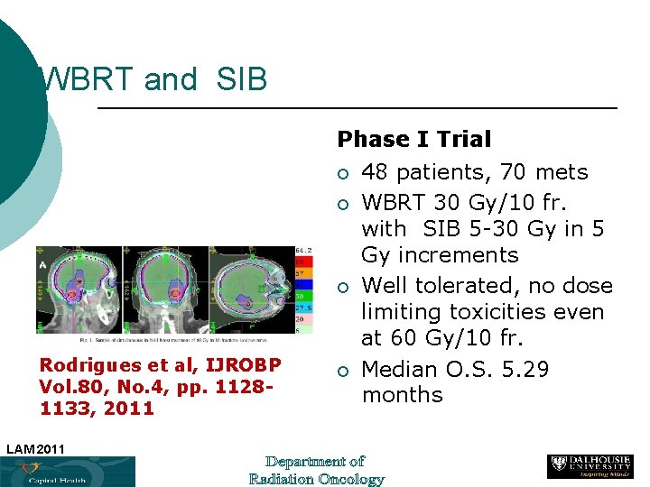 WBRT and SIB Phase I Trial ¡ ¡ ¡ Rodrigues et al, IJROBP Vol.