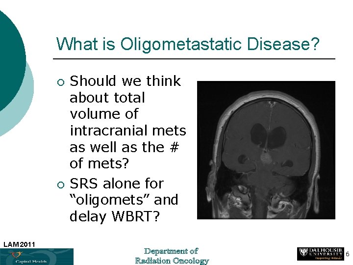 What is Oligometastatic Disease? ¡ ¡ Should we think about total volume of intracranial