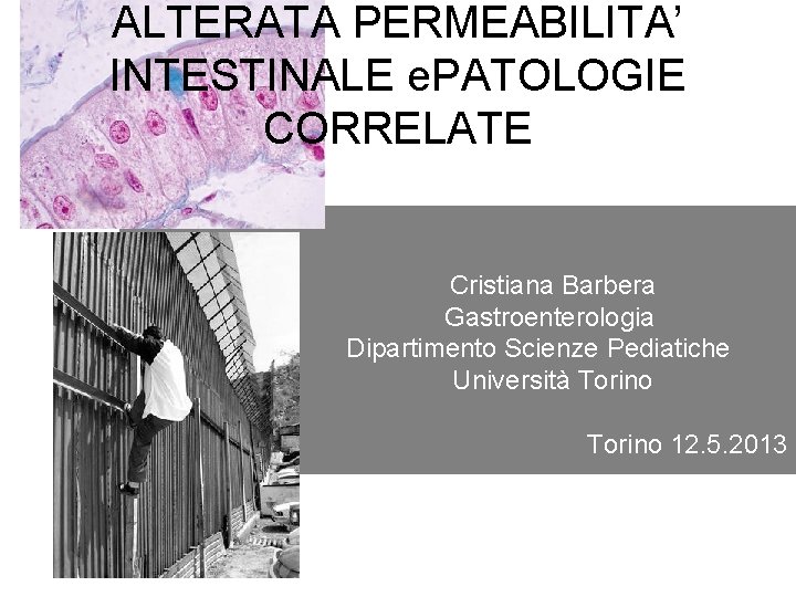 ALTERATA PERMEABILITA’ INTESTINALE e. PATOLOGIE CORRELATE Cristiana Barbera Gastroenterologia Dipartimento Scienze Pediatiche Università Torino
