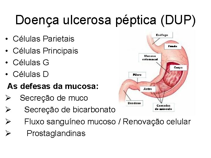 Doença ulcerosa péptica (DUP) • Células Parietais • Células Principais • Células G •