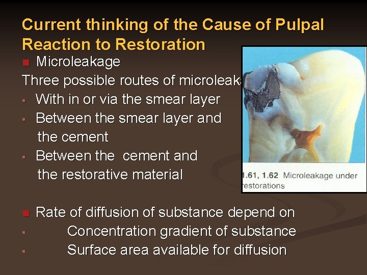 Current thinking of the Cause of Pulpal Reaction to Restoration Microleakage Three possible routes
