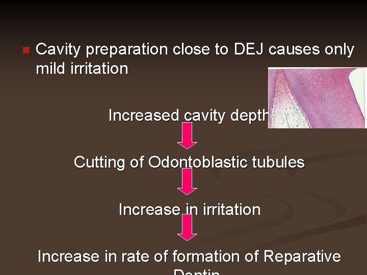n Cavity preparation close to DEJ causes only mild irritation Increased cavity depth Cutting