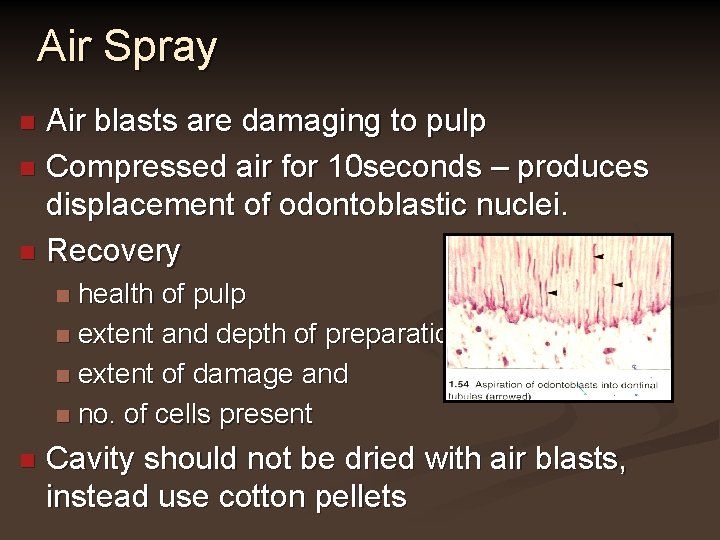 Air Spray Air blasts are damaging to pulp n Compressed air for 10 seconds