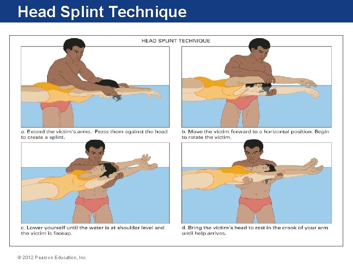 Head Splint Technique © 2012 Pearson Education, Inc. Head Splint Technique © 2012 Pearson Education, Inc.