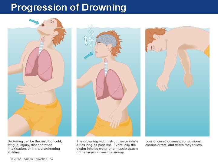 Progression of Drowning © 2012 Pearson Education, Inc. Progression of Drowning © 2012 Pearson Education, Inc.