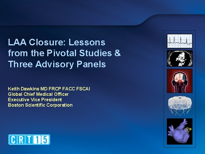 LAA Closure: Lessons from the Pivotal Studies & Three Advisory Panels Keith Dawkins MD