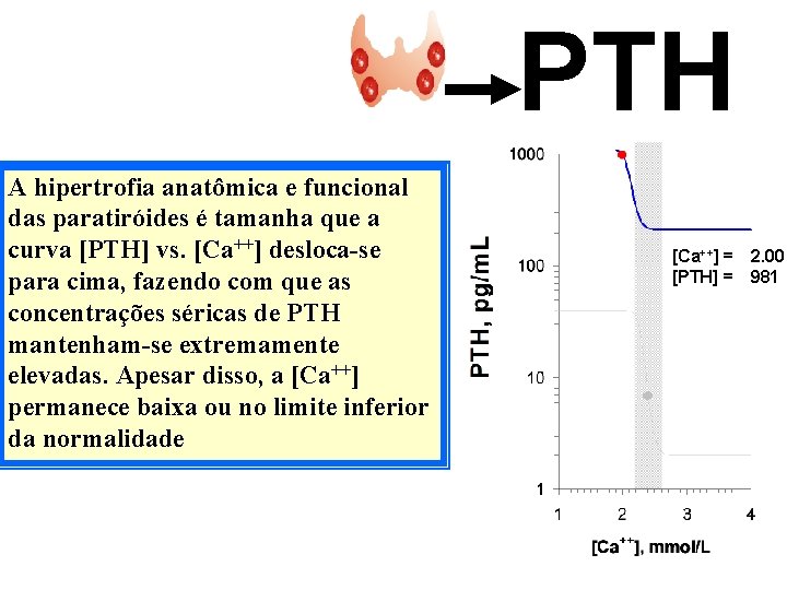 PTH A hipertrofia anatômica e funcional das paratiróides é tamanha que a curva [PTH]