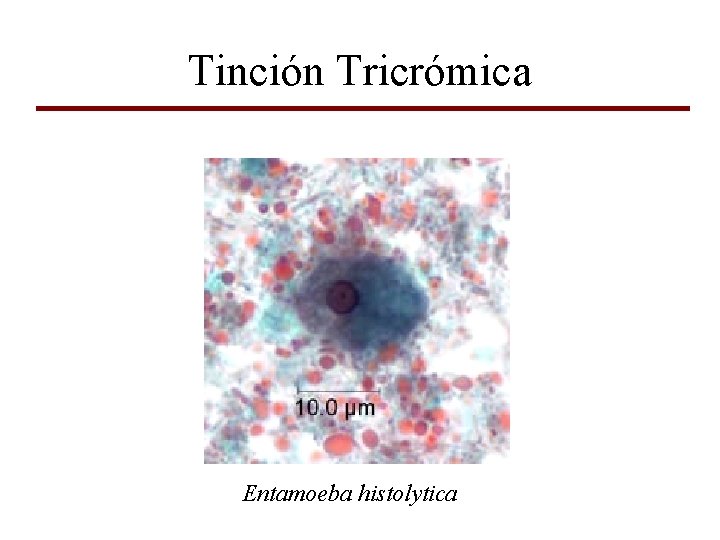 Tinción Tricrómica Entamoeba histolytica 