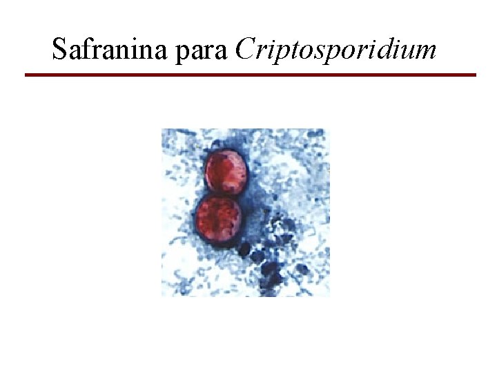 Safranina para Criptosporidium 