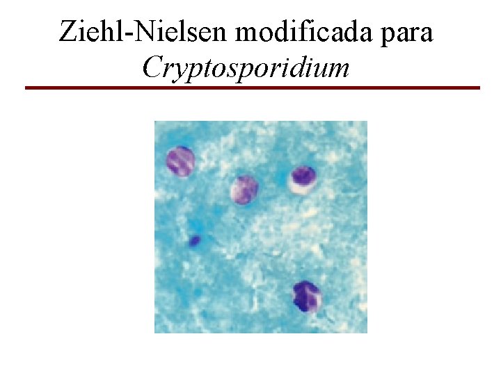 Ziehl-Nielsen modificada para Cryptosporidium 