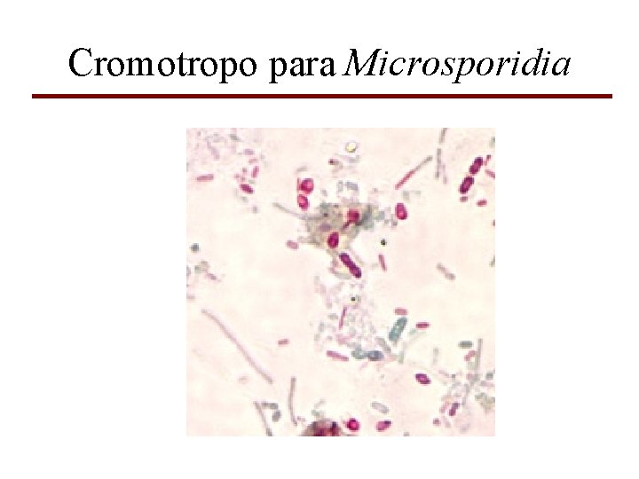 Cromotropo para Microsporidia 