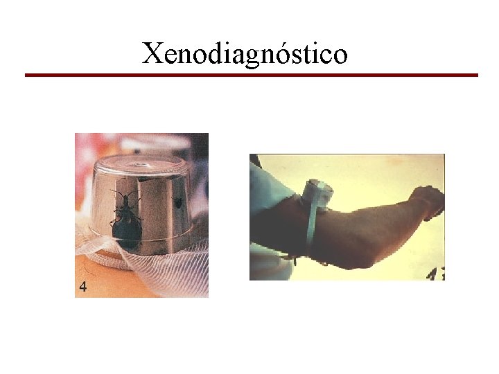 Xenodiagnóstico 