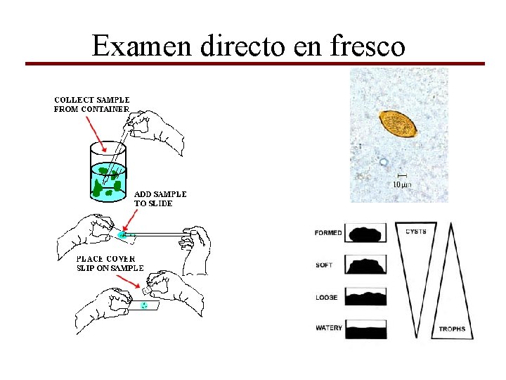 Examen directo en fresco 