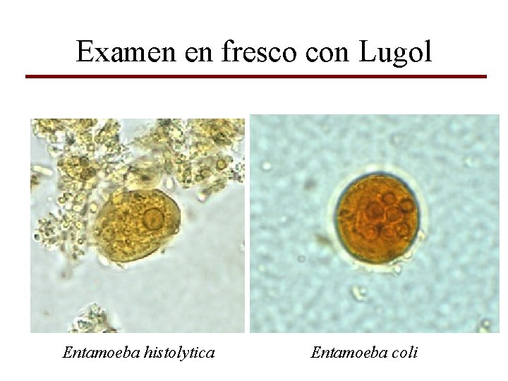 Examen en fresco con Lugol Entamoeba histolytica Entamoeba coli 
