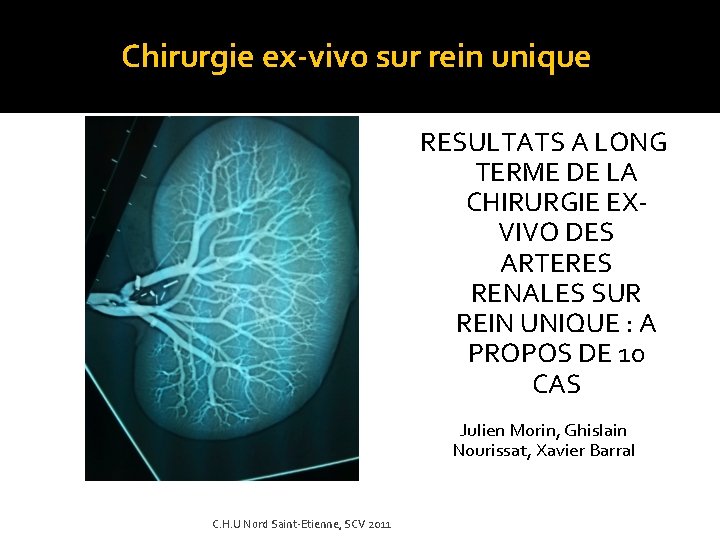 Chirurgie ex-vivo sur rein unique RESULTATS A LONG TERME DE LA CHIRURGIE EXVIVO DES