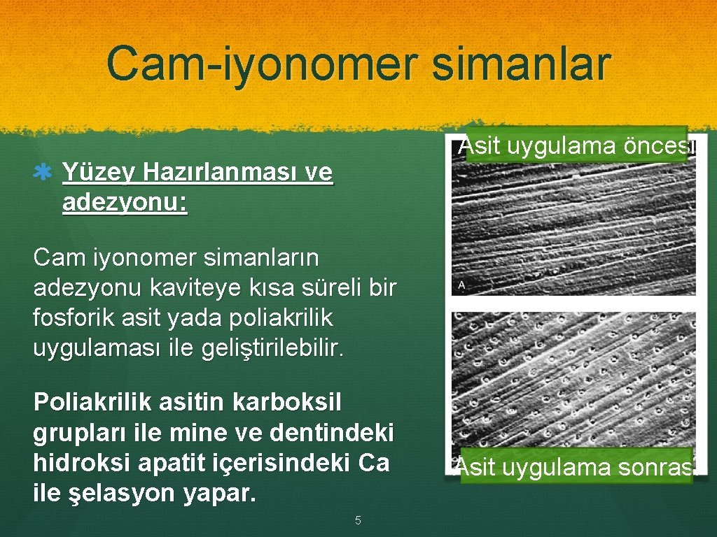 Cam-iyonomer simanlar Asit uygulama öncesi Yüzey Hazırlanması ve adezyonu: Cam iyonomer simanların adezyonu kaviteye