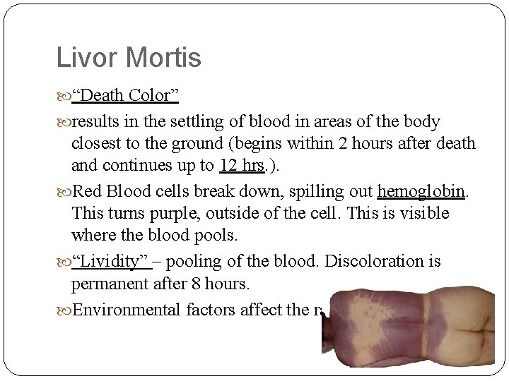 Livor Mortis “Death Color” results in the settling of blood in areas of the