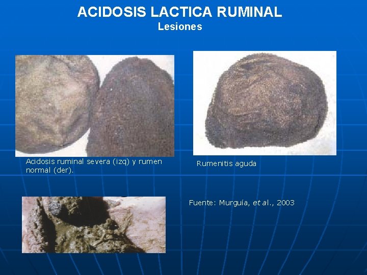 ACIDOSIS LACTICA RUMINAL Lesiones Acidosis ruminal severa (izq) y rumen normal (der). Rumenitis aguda