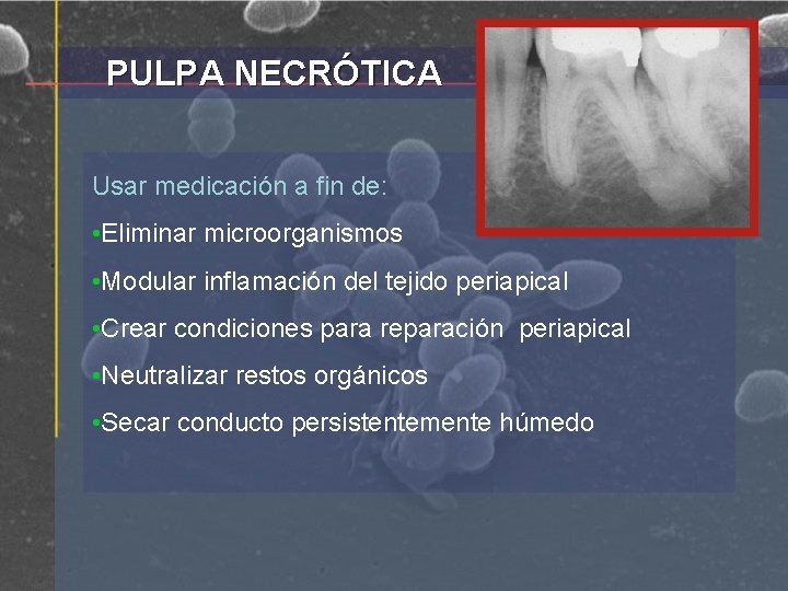 PULPA NECRÓTICA Usar medicación a fin de: • Eliminar microorganismos • Modular inflamación del