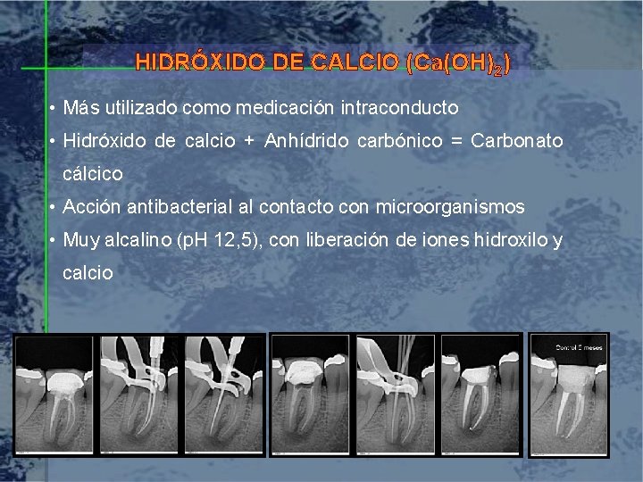 HIDRÓXIDO DE CALCIO (Ca(OH)2) • Más utilizado como medicación intraconducto • Hidróxido de calcio