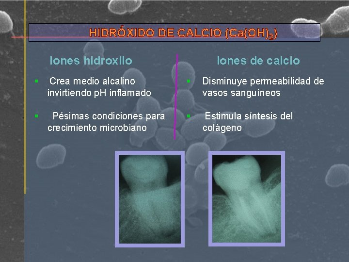 HIDRÓXIDO DE CALCIO (Ca(OH)2) Iones de calcio Iones hidroxilo § Crea medio alcalino invirtiendo