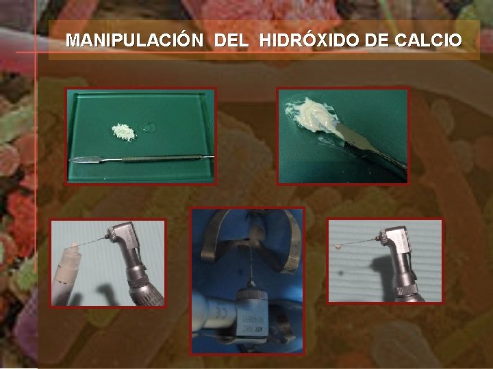 MANIPULACIÓN DEL HIDRÓXIDO DE CALCIO 