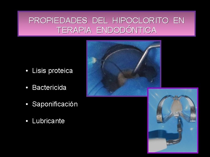 PROPIEDADES DEL HIPOCLORITO EN TERAPIA ENDODÓNTICA • Lisis proteica • Bactericida • Saponificación •